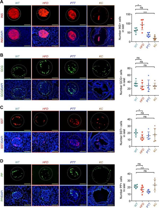 Somatostatin Antibody in Immunohistochemistry, Immunocytochemistry (IHC, ICC/IF)
