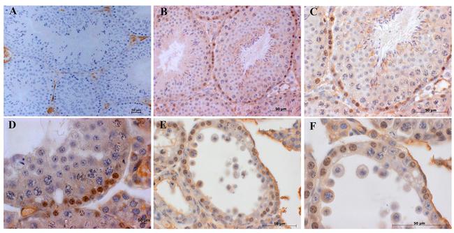 CD264 (TRAIL-R4) Antibody in Flow Cytometry (Flow)