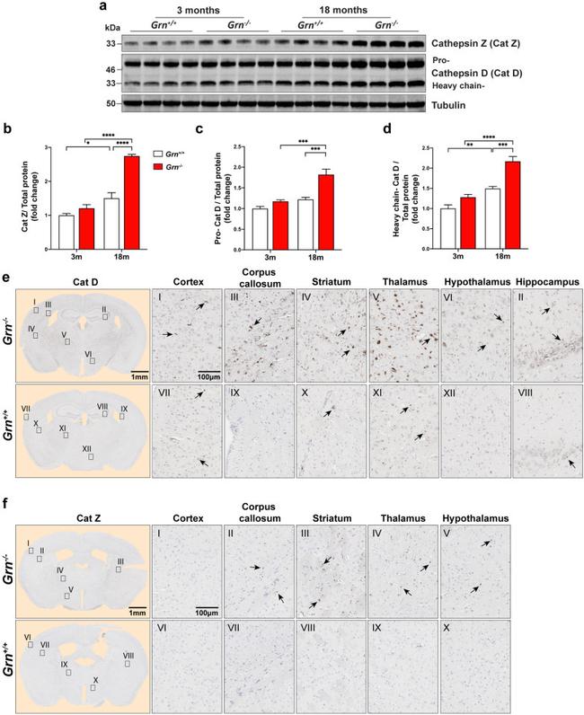 Cathepsin Z Antibody in Western Blot, Immunohistochemistry (WB, IHC)