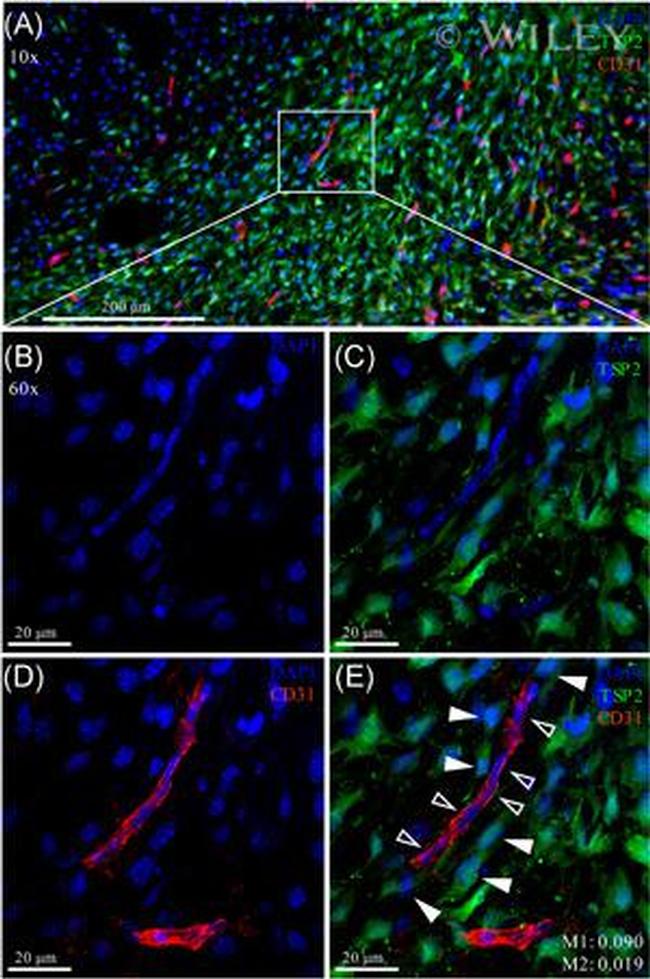 CD31 Antibody in Immunocytochemistry (ICC/IF)