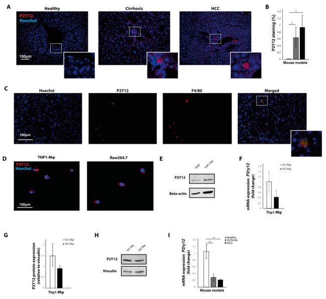 P2Y12 Antibody in Western Blot, Immunohistochemistry, Immunocytochemistry (WB, IHC, ICC/IF)