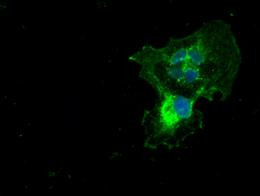 turboYFP Antibody in Immunocytochemistry (ICC/IF)