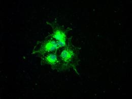 turboYFP Antibody in Immunocytochemistry (ICC/IF)