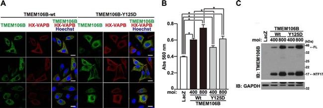 Xpress Antibody in Immunocytochemistry (ICC/IF)