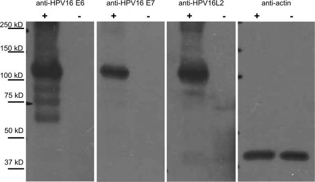 HPV Type 16 E7 Antibody in Western Blot (WB)