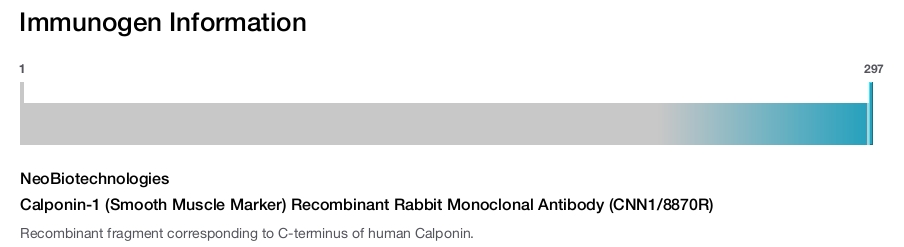 Calponin-1 (Smooth Muscle Marker) Recombinant Rabbit Monoclonal Antibody (CNN1/8870R)