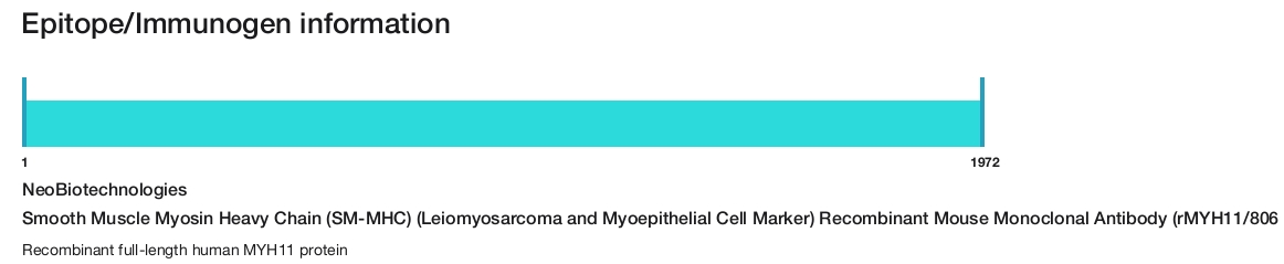 Smooth Muscle Myosin Heavy Chain (SM-MHC) (Leiomyosarcoma and Myoepithelial Cell Marker) Recombinant Mouse Monoclonal Antibody (rMYH11/8066)