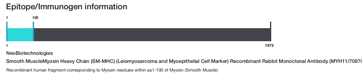 Smooth MuscleMyosin Heavy Chain (SM-MHC) (Leiomyosarcoma and Myoepithelial Cell Marker) Recombinant Rabbit Monoclonal Antibody (MYH11/7087R)