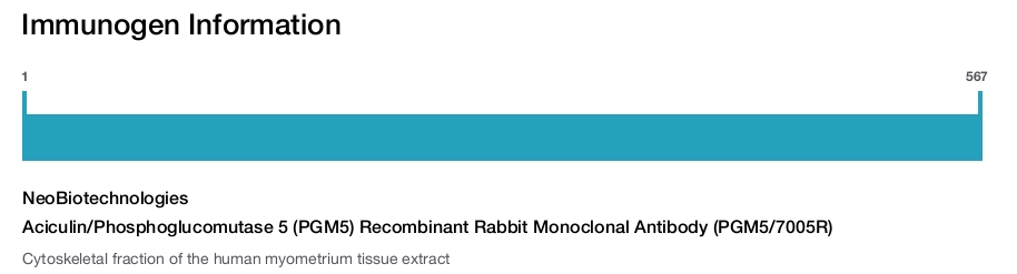Aciculin/Phosphoglucomutase 5 (PGM5) Recombinant Rabbit Monoclonal Antibody (PGM5/7005R)