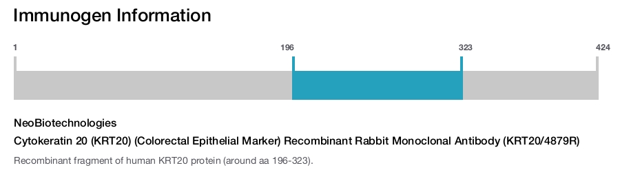 Cytokeratin 20 (KRT20) (Colorectal Epithelial Marker) Recombinant Rabbit Monoclonal Antibody (KRT20/4879R)
