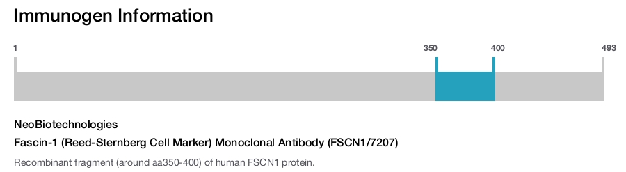 Fascin-1 (Reed-Sternberg Cell Marker) Monoclonal Antibody (FSCN1/7207)