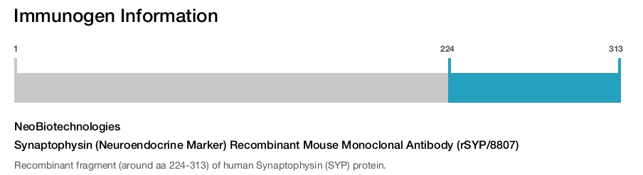 Synaptophysin (Neuroendocrine Marker) Recombinant Mouse Monoclonal Antibody (rSYP/8807)