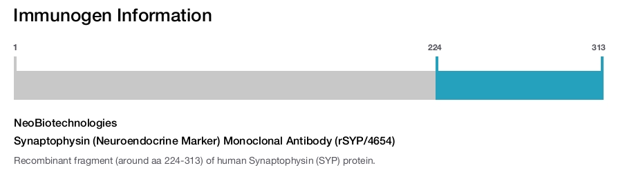 Synaptophysin (Neuroendocrine Marker) Monoclonal Antibody (rSYP/4654)