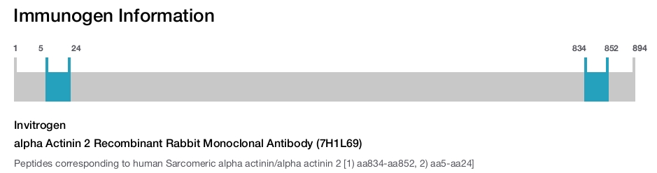 alpha Actinin 2 Recombinant Rabbit Monoclonal Antibody (7H1L69)