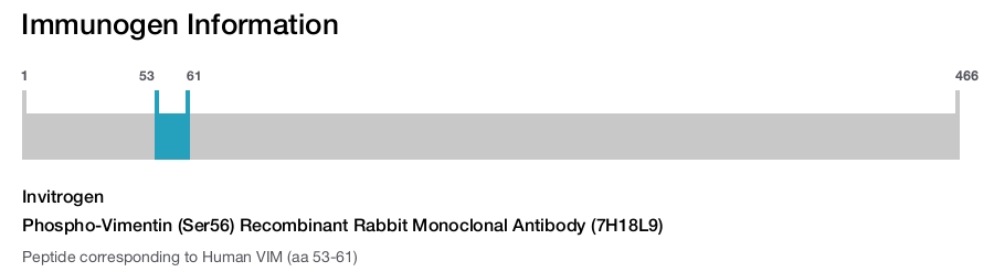 Phospho-Vimentin (Ser56) Recombinant Rabbit Monoclonal Antibody (7H18L9)