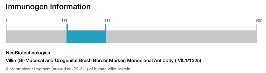 Villin (GI-Mucosal and Urogenital Brush Border Marker) Monoclonal Antibody (rVIL1/1325)