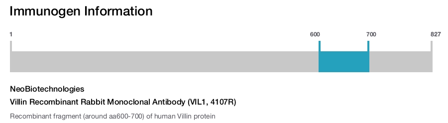Villin Recombinant Rabbit Monoclonal Antibody (VIL1, 4107R)