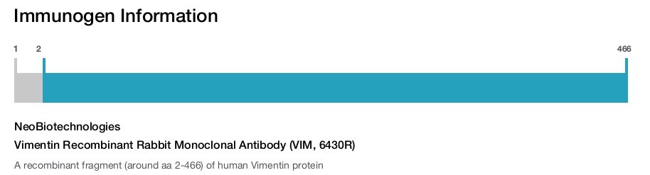 Vimentin Recombinant Rabbit Monoclonal Antibody (VIM, 6430R)