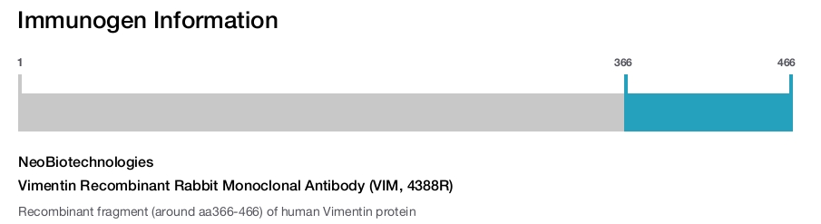 Vimentin Recombinant Rabbit Monoclonal Antibody (VIM, 4388R)