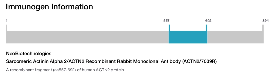 Sarcomeric Actinin Alpha 2/ACTN2 Recombinant Rabbit Monoclonal Antibody (ACTN2/7039R)