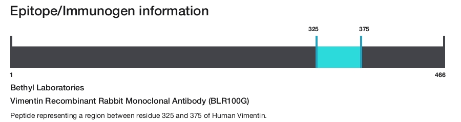 Vimentin Recombinant Rabbit Monoclonal Antibody (BLR100G)