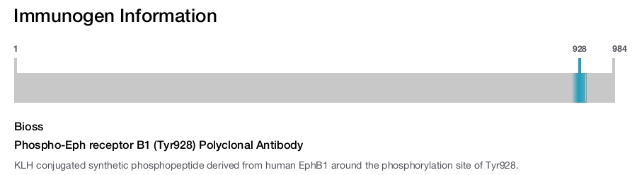 Phospho-Eph receptor B1 (Tyr928) Polyclonal Antibody