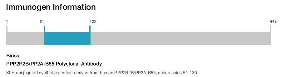PPP2R2B/PP2A-B55 Polyclonal Antibody