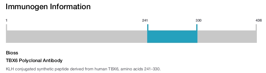 TBX6 Polyclonal Antibody
