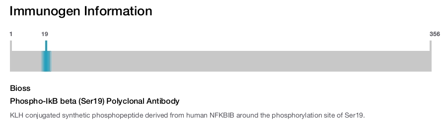 Phospho-IkB beta (Ser19) Polyclonal Antibody