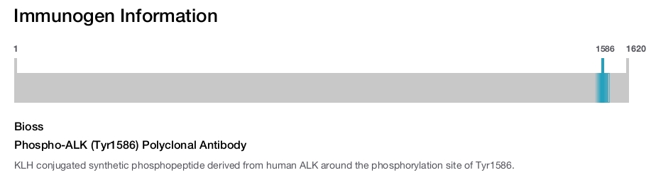 Phospho-ALK (Tyr1586) Polyclonal Antibody