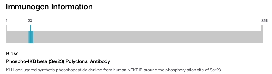 Phospho-IKB beta (Ser23) Polyclonal Antibody