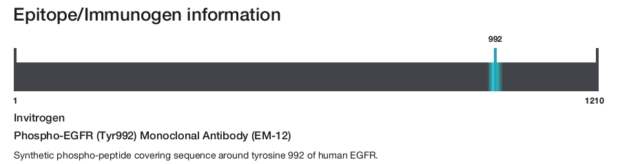 Phospho-EGFR (Tyr992) Monoclonal Antibody (EM-12)