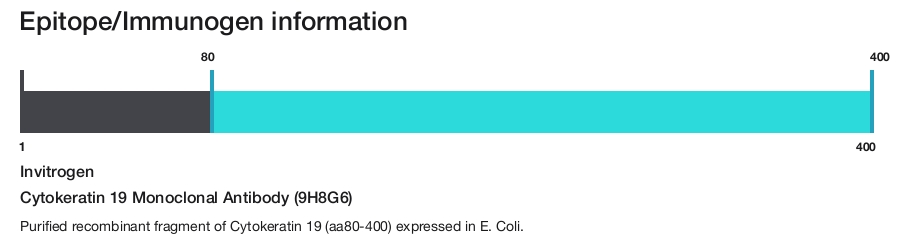 Cytokeratin 19 Monoclonal Antibody (9H8G6)