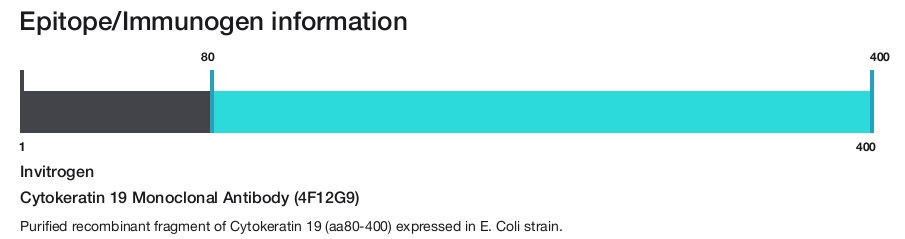 Cytokeratin 19 Monoclonal Antibody (4F12G9)
