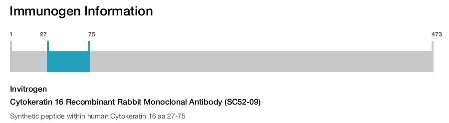 Cytokeratin 16 Recombinant Rabbit Monoclonal Antibody (SC52-09)