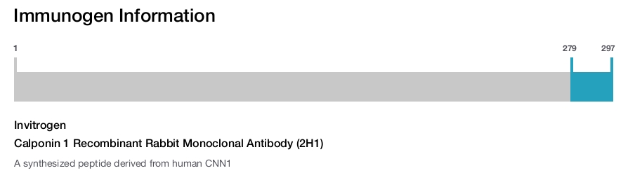 Calponin 1 Recombinant Rabbit Monoclonal Antibody (2H1)