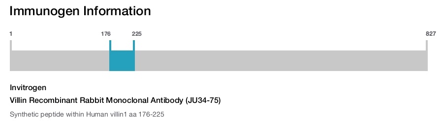Villin Recombinant Rabbit Monoclonal Antibody (JU34-75)