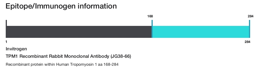TPM1 Recombinant Rabbit Monoclonal Antibody (JG38-66)