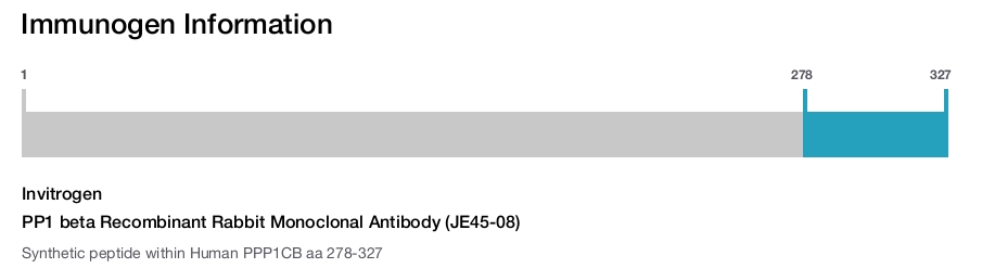 PP1 beta Recombinant Rabbit Monoclonal Antibody (JE45-08)