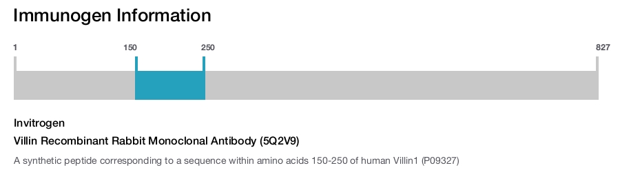 Villin Recombinant Rabbit Monoclonal Antibody (5Q2V9)