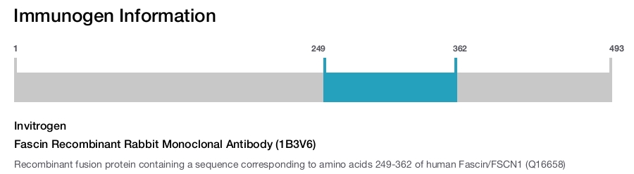 Fascin Recombinant Rabbit Monoclonal Antibody (1B3V6)