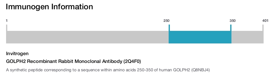 GOLPH2 Recombinant Rabbit Monoclonal Antibody (2Q4F0)
