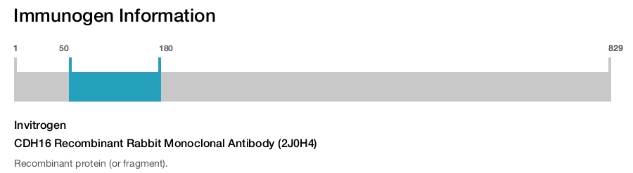 CDH16 Recombinant Rabbit Monoclonal Antibody (2J0H4)