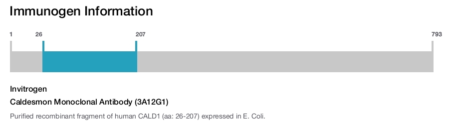 Caldesmon Monoclonal Antibody (3A12G1)