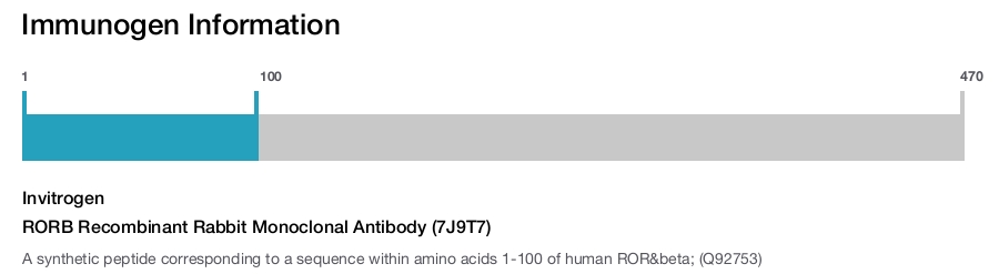 RORB Recombinant Rabbit Monoclonal Antibody (7J9T7)