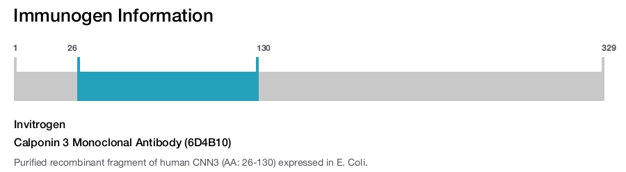 Calponin 3 Monoclonal Antibody (6D4B10)