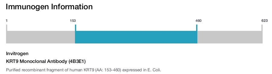 KRT9 Monoclonal Antibody (4B3E1)