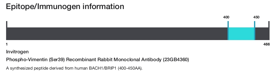 Phospho-Vimentin (Ser39) Recombinant Rabbit Monoclonal Antibody (23GB4360)
