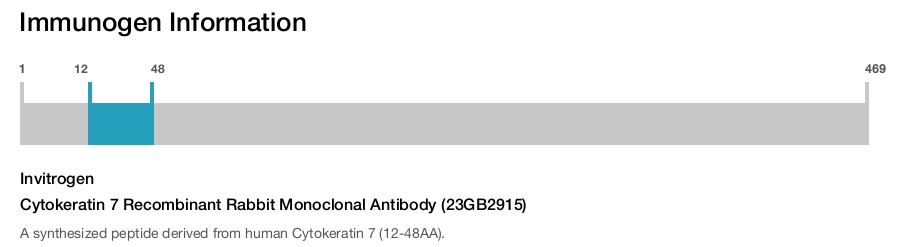 Cytokeratin 7 Recombinant Rabbit Monoclonal Antibody (23GB2915)