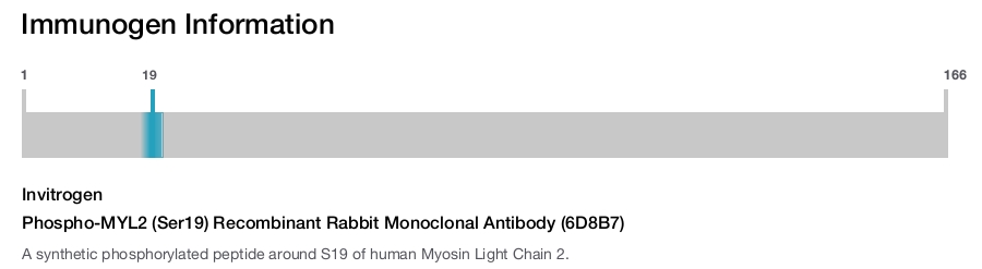 Phospho-MYL2 (Ser19) Recombinant Rabbit Monoclonal Antibody (6D8B7)